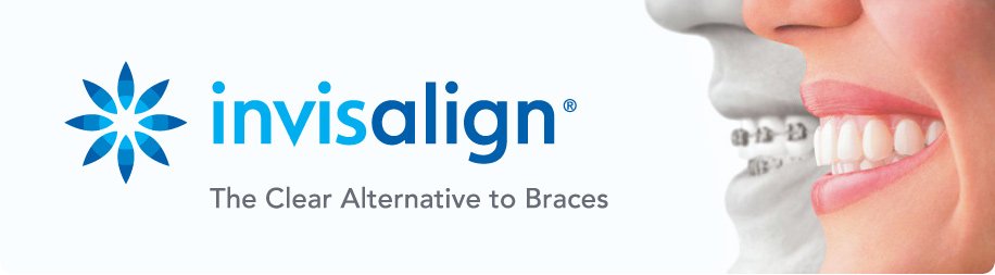 invisalign image