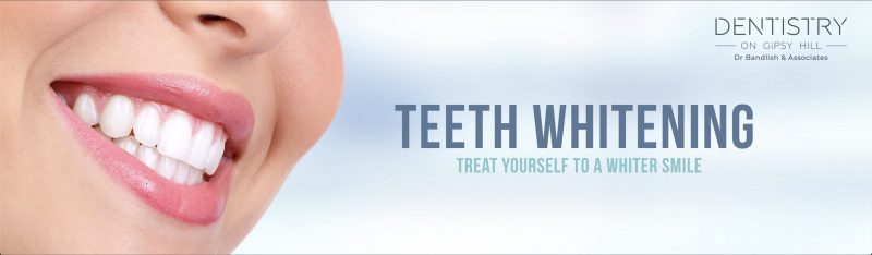 Teeth Whitening Offer banner