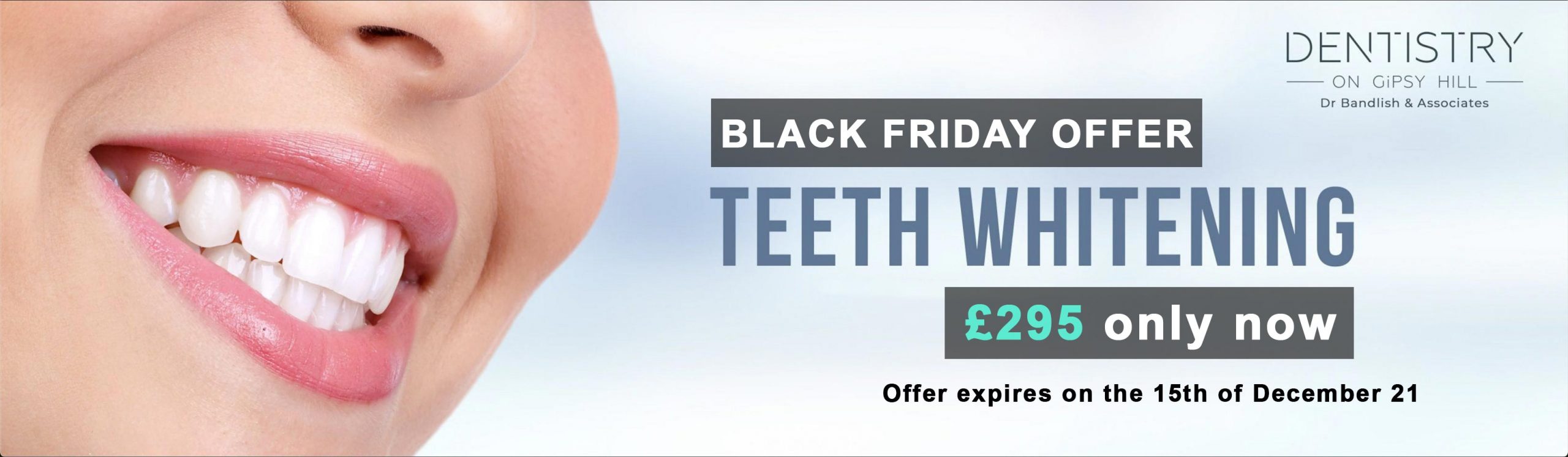 Teeth Whitening Offer banner