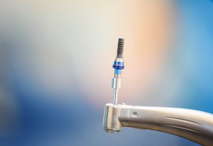 What Happens If You Don’t Replace a Missing Tooth?
