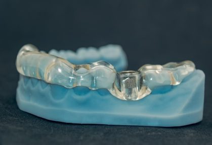 Dental Implant Recovery Timeline